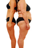 Back to back, the skinny and obese lady are so obviously different to look at.